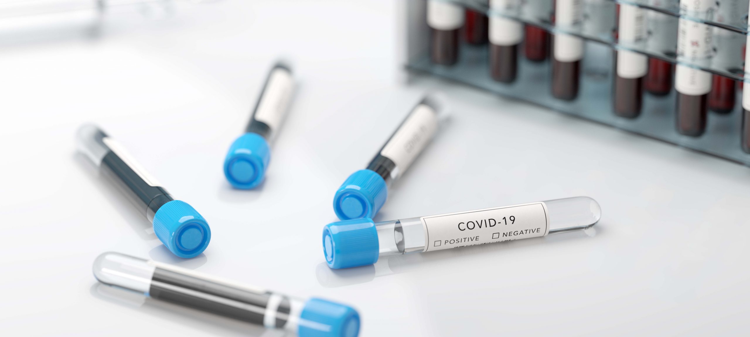 koronavíris szerológiai teszt