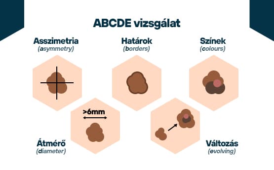 abcde vizsgálat